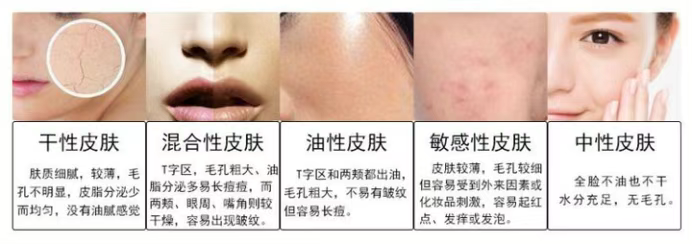 皮肤的类型